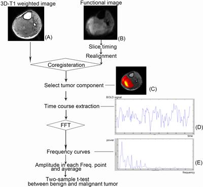 Comparing the blood oxygen level–dependent fluctuation power of benign and malignant musculoskeletal tumors using functional magnetic resonance imaging